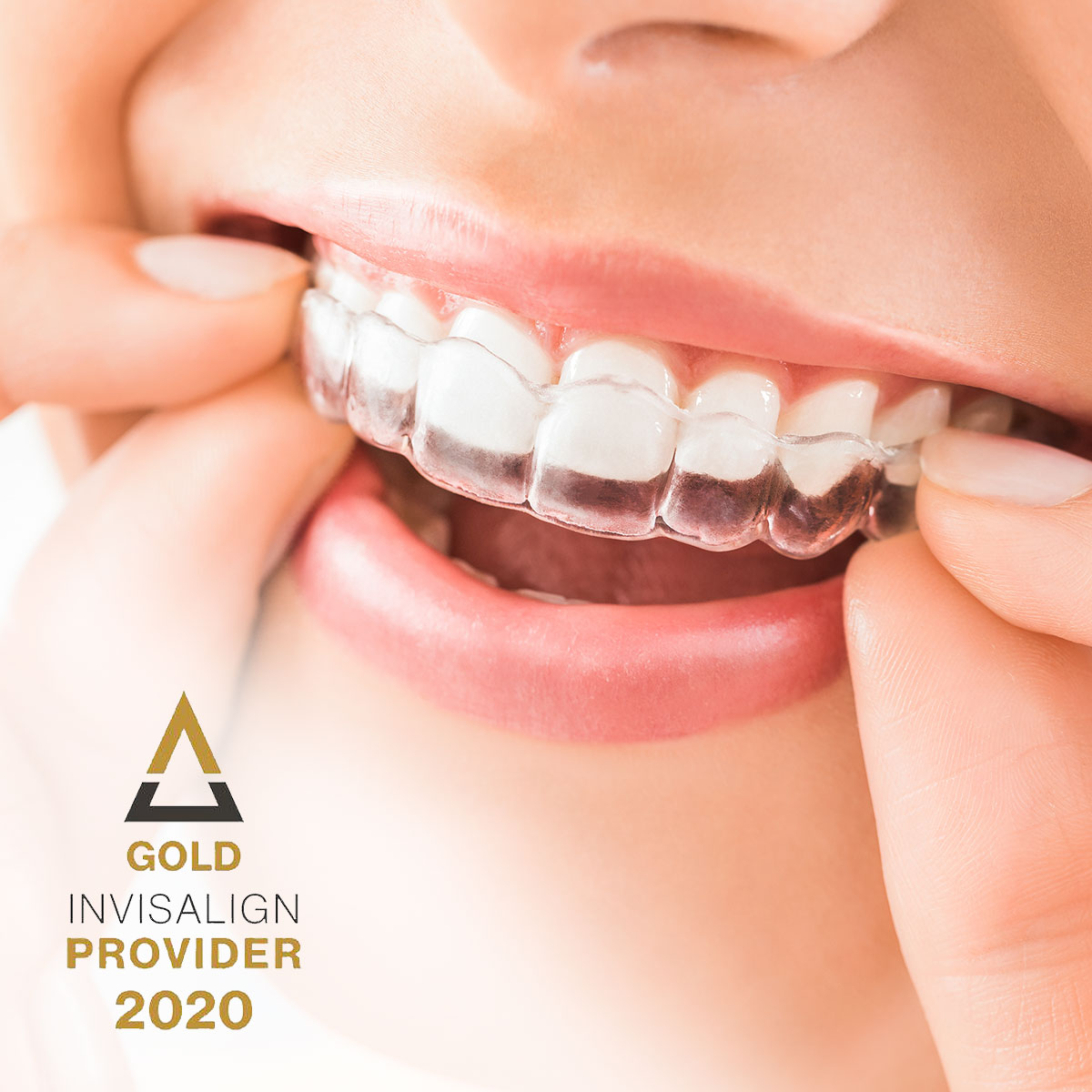 gold Invisalign provider 2020